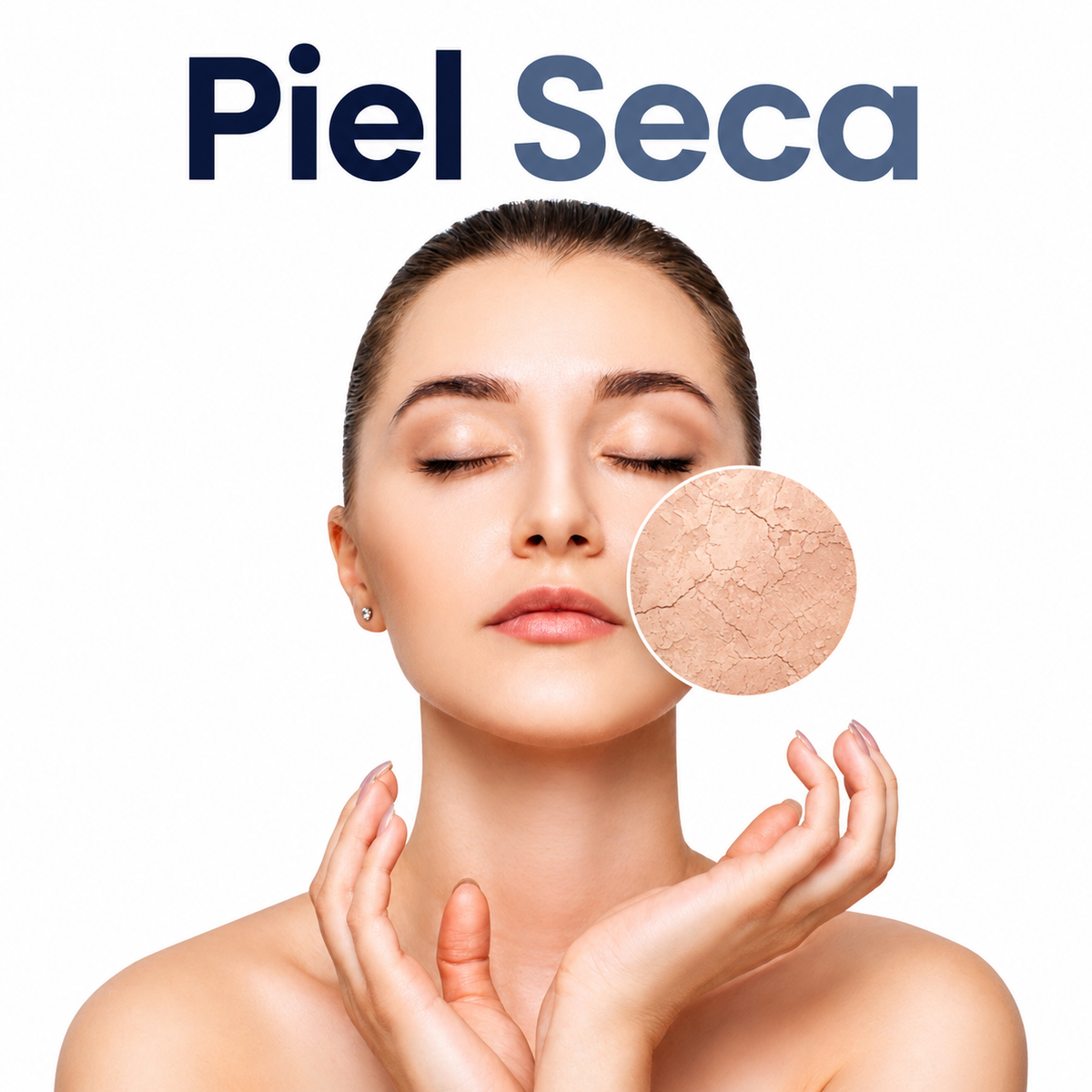 Piel Seca